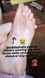 Aahana Kumra feet photo 18
