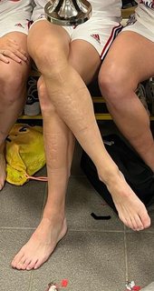 Ada Hegerberg feet photo 16
