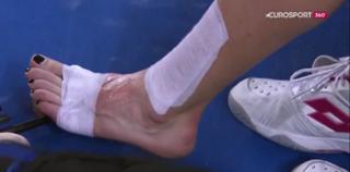 Aga Radwanska feet photo thumbnail