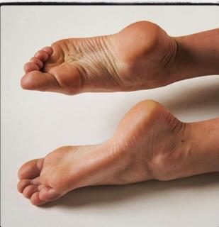 Alana Ferri feet photo 2