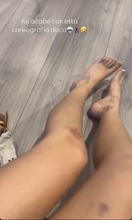Alana Literas feet photo 7
