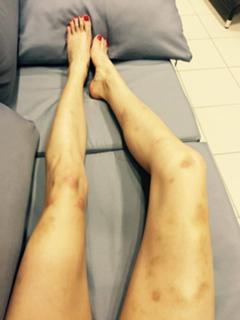 Aleksandra Ciupa feet photo thumbnail