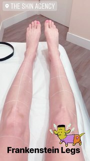 Alessandra Torresani feet photo thumbnail