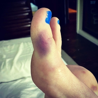 Alice Evans feet photo 1