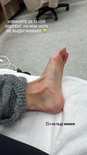 Alina Zagitova feet photo thumbnail