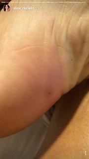 Aline Campos feet photo thumbnail