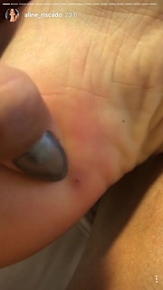 Aline Campos feet photo thumbnail