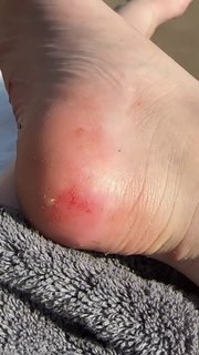 Allie Sherlock feet photo 17