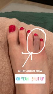 Allison Raskin feet photo thumbnail