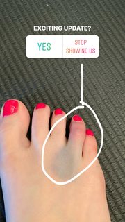 Allison Raskin feet photo thumbnail