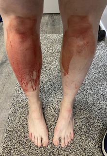 Allison Tolman feet photo 1
