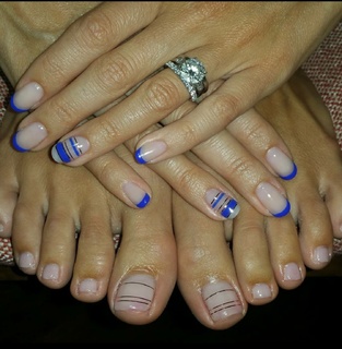 Allison Williams feet photo thumbnail