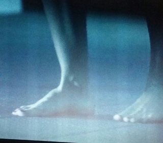 Amanda Walsh feet photo 18