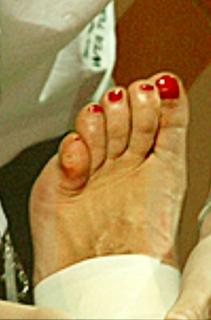 Ana Ivanovic feet photo thumbnail