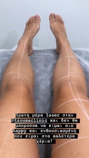 Anastasia Tsilimpiou feet photo 7