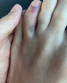 Andrea Delogu feet photo thumbnail