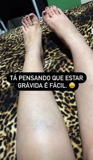 Andressa Urach feet photo thumbnail