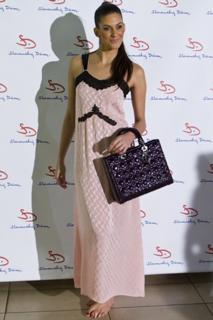 Aneta Vignerová feet photo 9