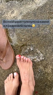 Anfisa Chekhova feet photo thumbnail