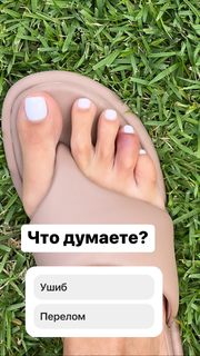 Anfisa Chekhova feet photo thumbnail