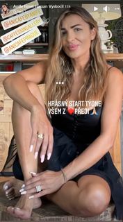 Anife Vyskocilová feet photo 17