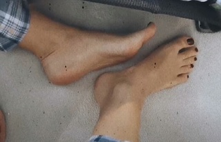 Anita Dujić Broadfoot feet photo 12