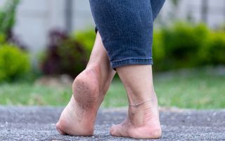 Anna Dreamfeet feet photo thumbnail