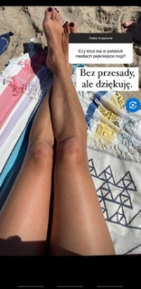 Anna Kalczynska feet photo 19