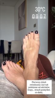 Anna Kalczynska feet photo 12