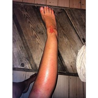 Anne Gadegaard feet photo 11