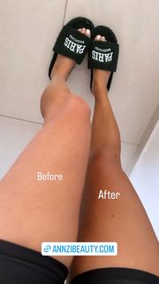 Anne Zivi feet photo 15