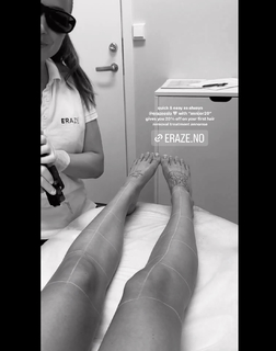 Anniken Englund Jørgesen feet photo 10