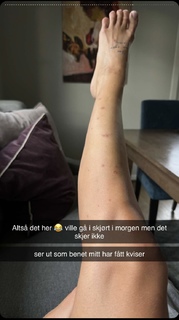 Anniken Englund Jørgesen feet photo 8