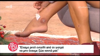 Apostolia Zoi feet photo thumbnail