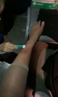 Ashley Graham feet photo thumbnail