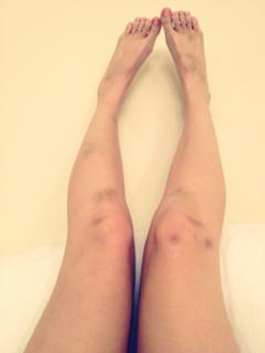 Ashley Johnson feet photo thumbnail