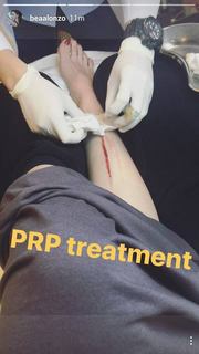 Bea Alonzo feet photo 19