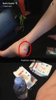 Bella Hadid feet photo thumbnail