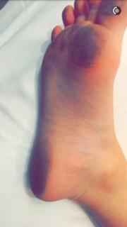 Bianca Anchieta feet photo thumbnail