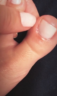 Bianca Anchieta feet photo thumbnail