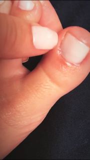 Bianca Anchieta feet photo thumbnail