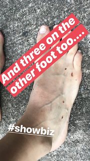 Bojana Novakovic feet photo thumbnail