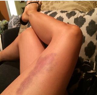 Brittany Furlan feet photo thumbnail