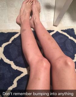 Brittany Furlan feet photo thumbnail