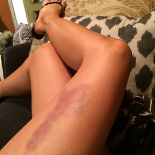 Brittany Furlan feet photo thumbnail