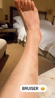 Caity Lotz feet photo thumbnail