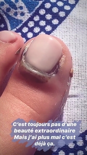 Camille Cerf feet photo thumbnail