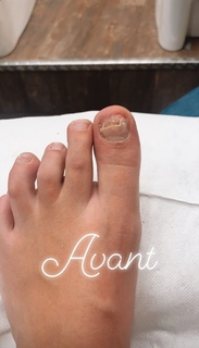 Camille Cerf feet photo thumbnail