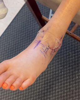 Candace Parker feet photo thumbnail