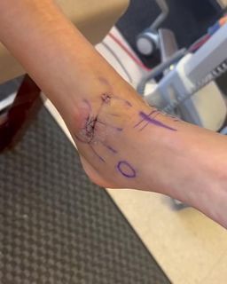 Candace Parker feet photo thumbnail